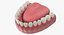 Colección de implantes dentales 2