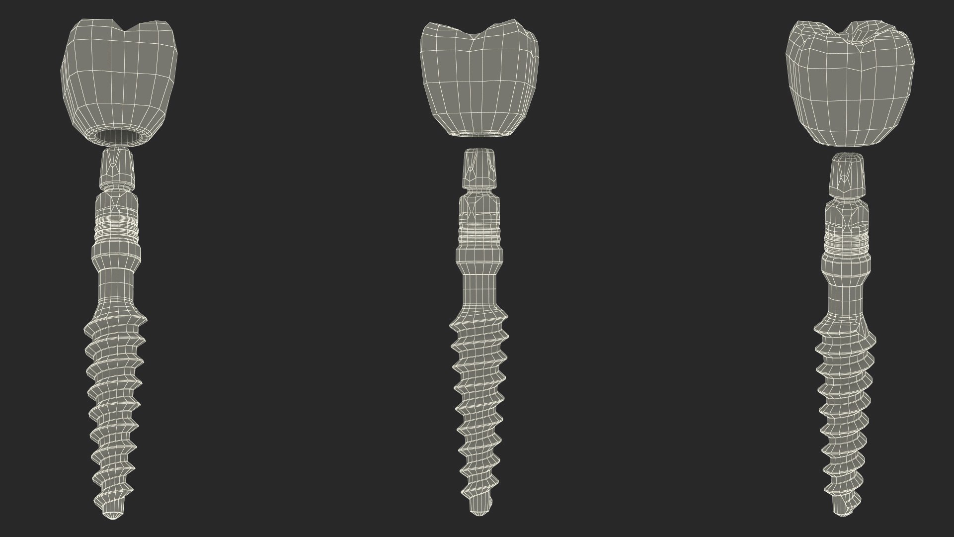 Tooth Implants Collection 2 3D model https://p.turbosquid.com/ts-thumb/4x/50dBRt/aa/toothimplantscollection23dsmodel081/jpg/1698620640/1920x1080/fit_q87/0652ac4719538a4afaeaf0cc1965aaf5826a9ad5/toothimplantscollection23dsmodel081.jpg