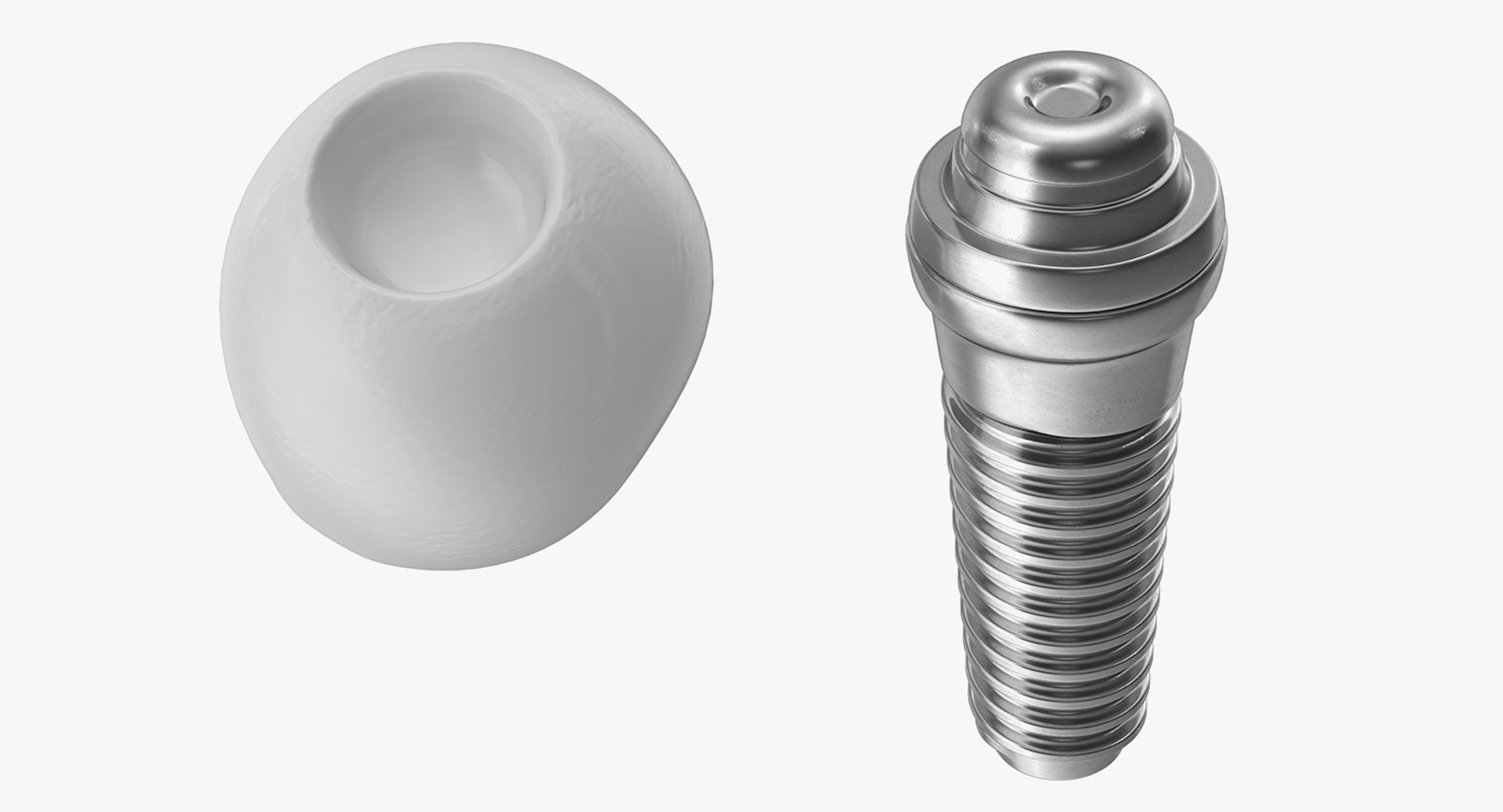 Tooth Implants Collection 2 3D model https://p.turbosquid.com/ts-thumb/4x/50dBRt/zl/toothimplantscollection23dsmodel052/jpg/1698620528/1920x1080/fit_q87/bbe8b77d5d3d16b3eb5fc1339c19d74de9c1b423/toothimplantscollection23dsmodel052.jpg