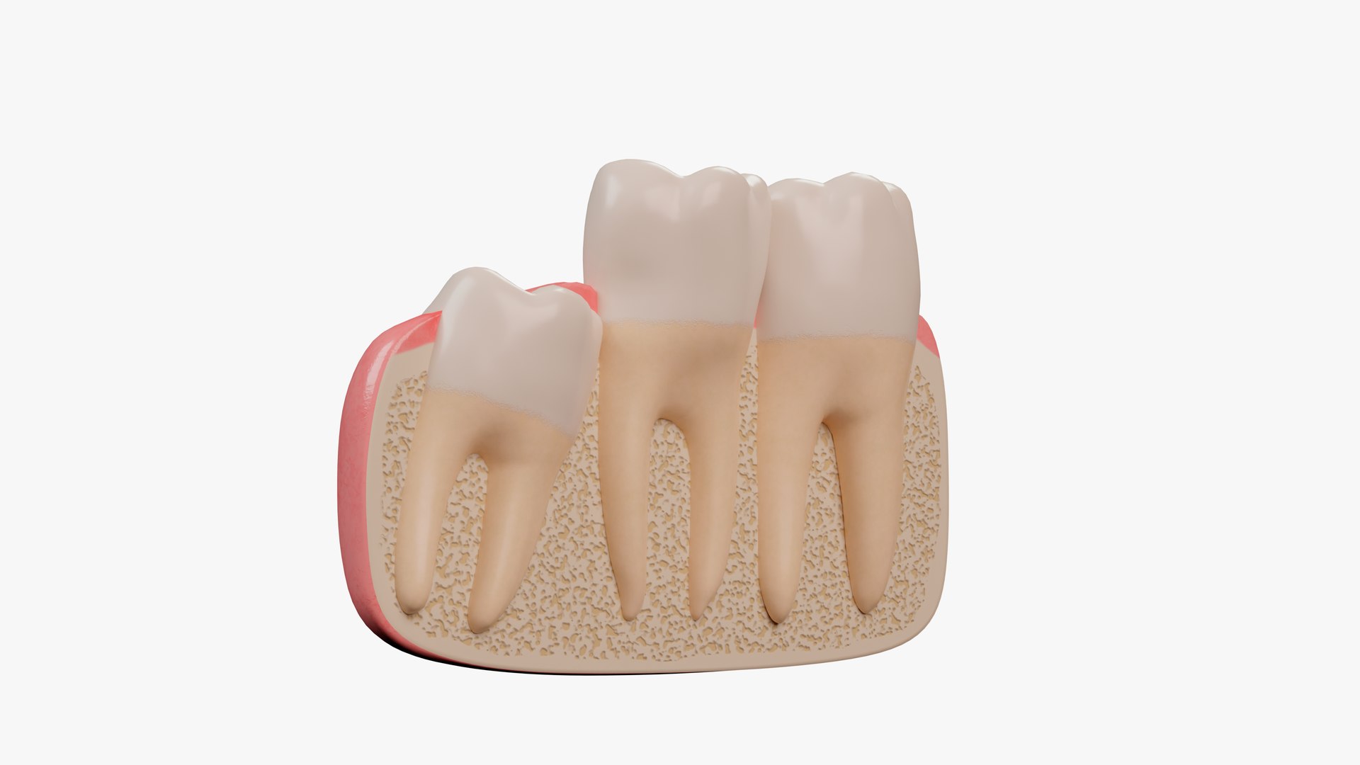 Impacted Wisdom Teeth Incision Model - TurboSquid 1866827