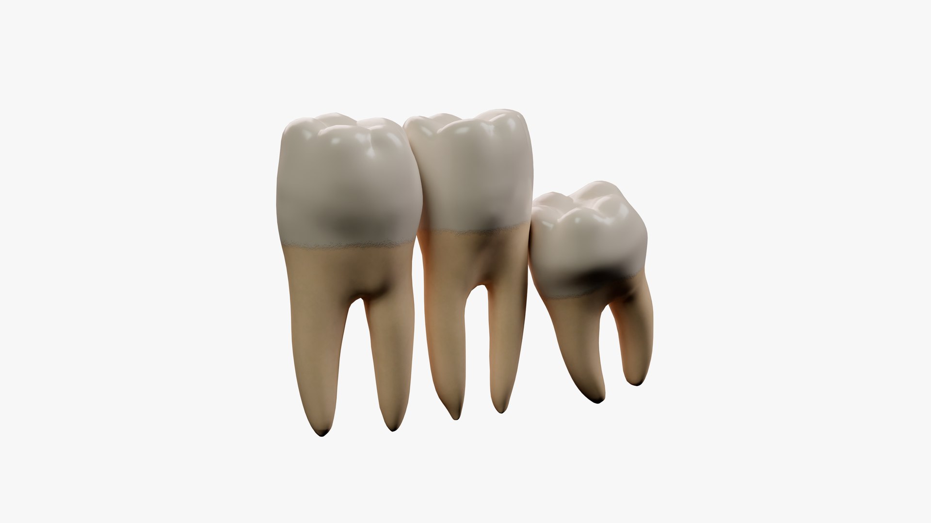 Impacted Wisdom Teeth Incision Model - TurboSquid 1866827