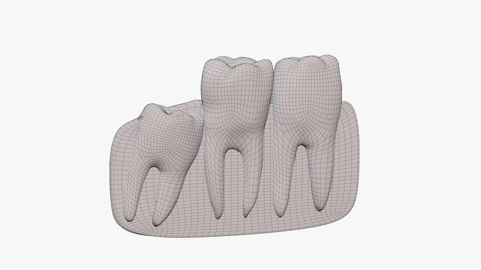 Impacted Wisdom Teeth Incision Model - TurboSquid 1866827