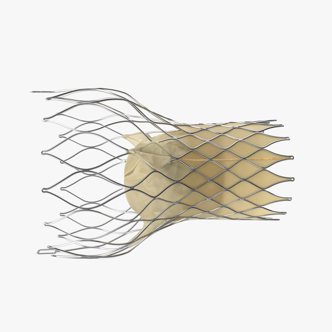 Transcatheter Aortic Valve Implant Obj