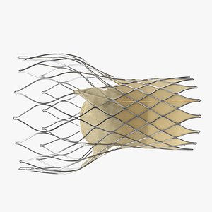 transcatheter aortic valve implant obj