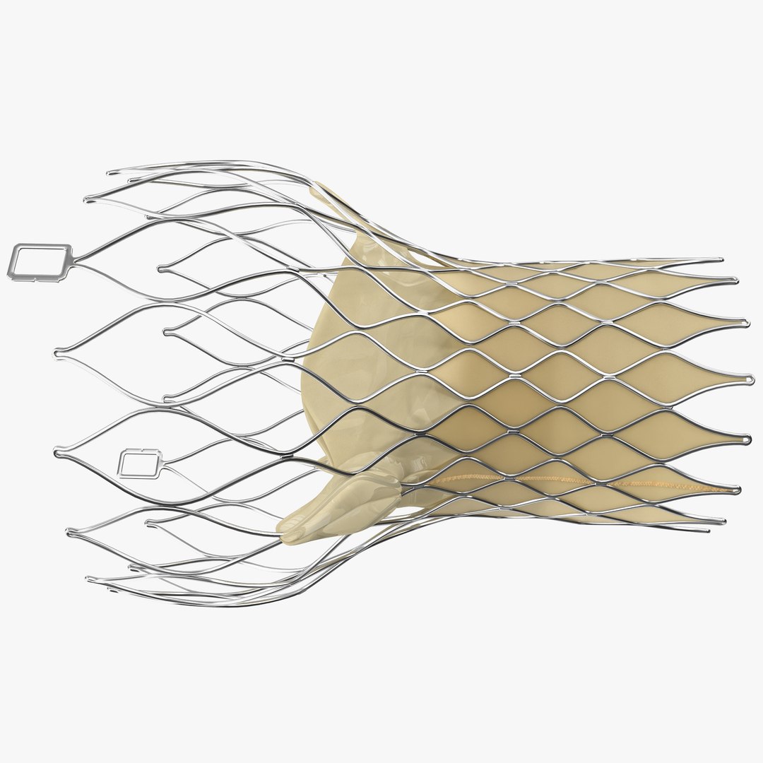 Transcatheter Aortic Valve Implant Obj