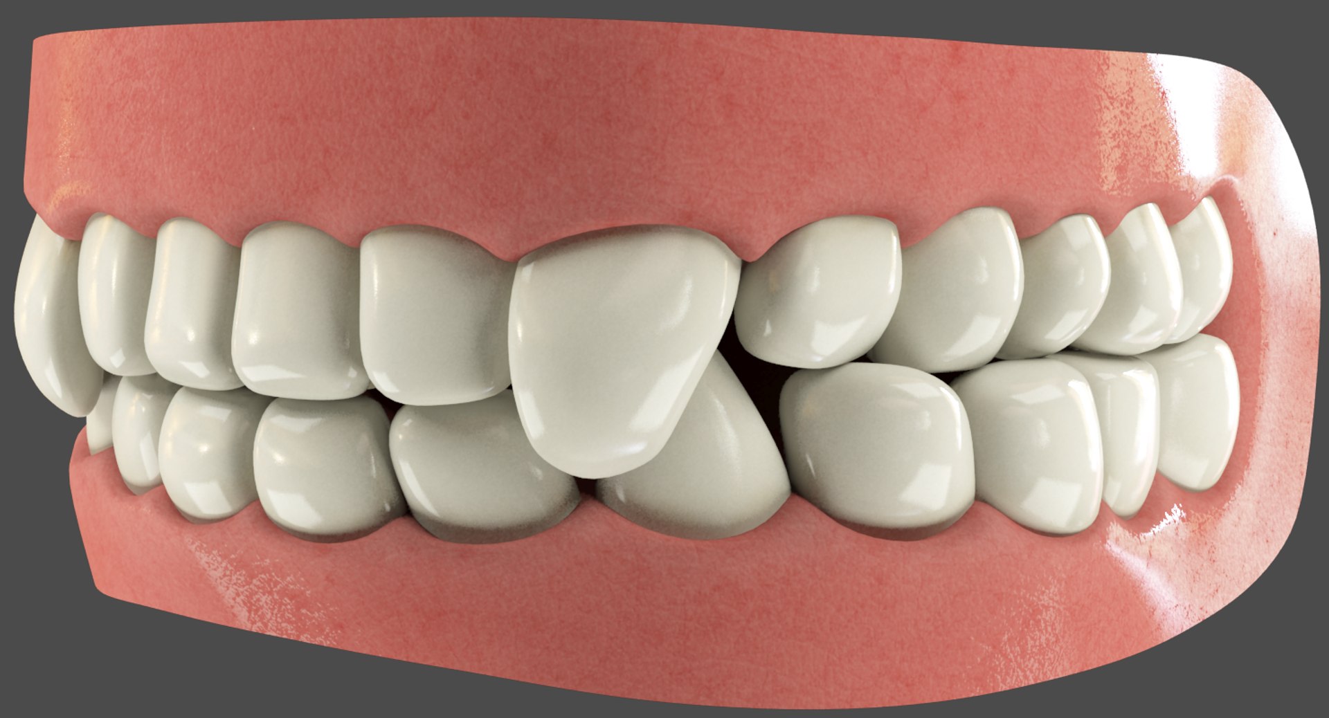 teeth gums tongue 3D model https://p.turbosquid.com/ts-thumb/5B/Gv8RPf/rMTn2OGt/002/png/1495220224/1920x1080/fit_q87/19a2b00c0894faab1d26105e20f463154252b527/002.jpg