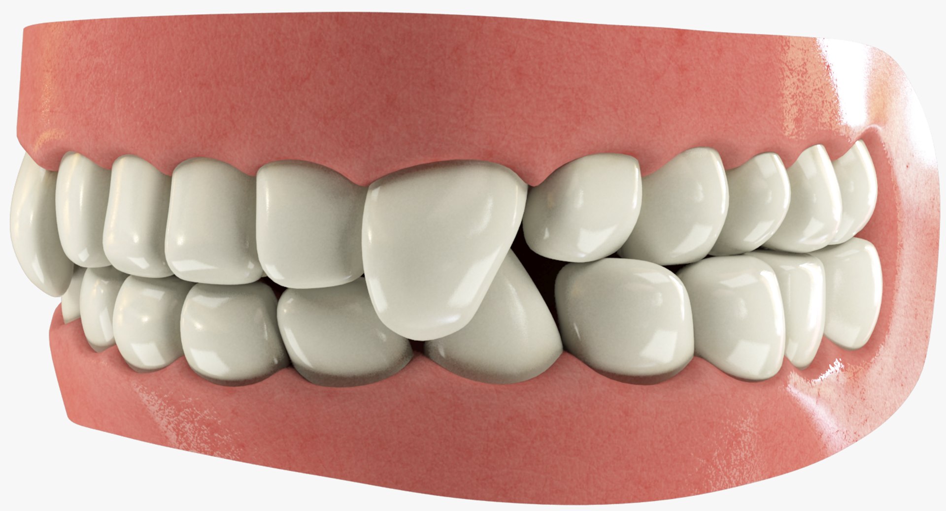 teeth gums tongue 3D model https://p.turbosquid.com/ts-thumb/5B/Gv8RPf/squbH44W/001/png/1495220222/1920x1080/fit_q87/8f7ce96ba4ec11bf60636db2a1a2725200476b16/001.jpg