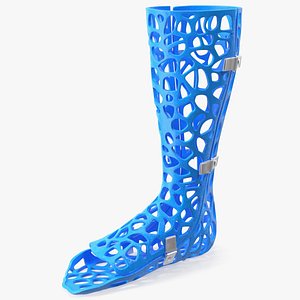 3D-Printed Orthopedic Cast Leg Blue 3D