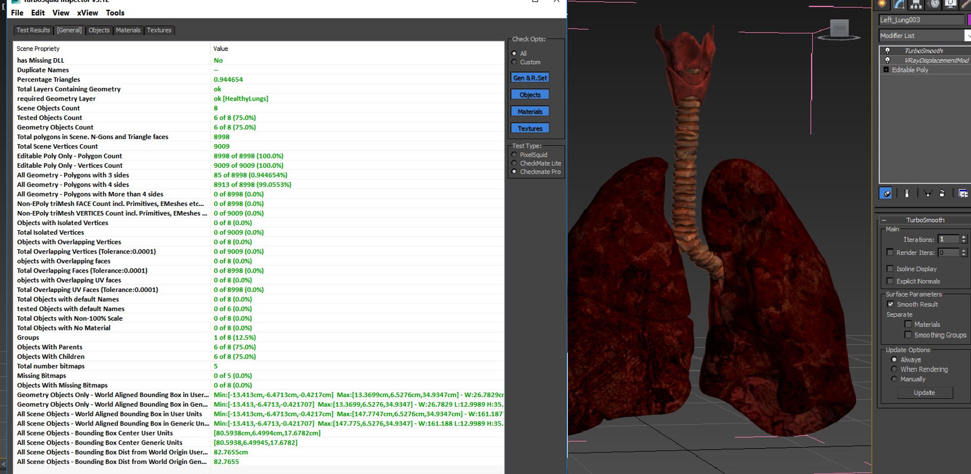 smoker s lungs 3D model https://p.turbosquid.com/ts-thumb/5X/qS326J/m0wcm0sA/20201210_154034/jpg/1607624413/1920x1080/fit_q87/b231c99cce17f9534b052264e335bf22787dfe37/20201210_154034.jpg