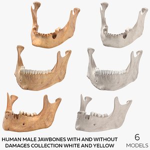 Human Male Jawbones With And Without Damages Collection White and Yellow - 6 models