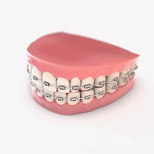fake teeth braces model