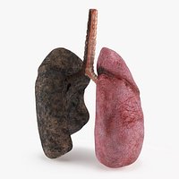 Dual Lung Anatomy Healthy and Damaged by Smoking