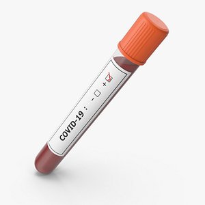 Covid-19 Positive Test Tube