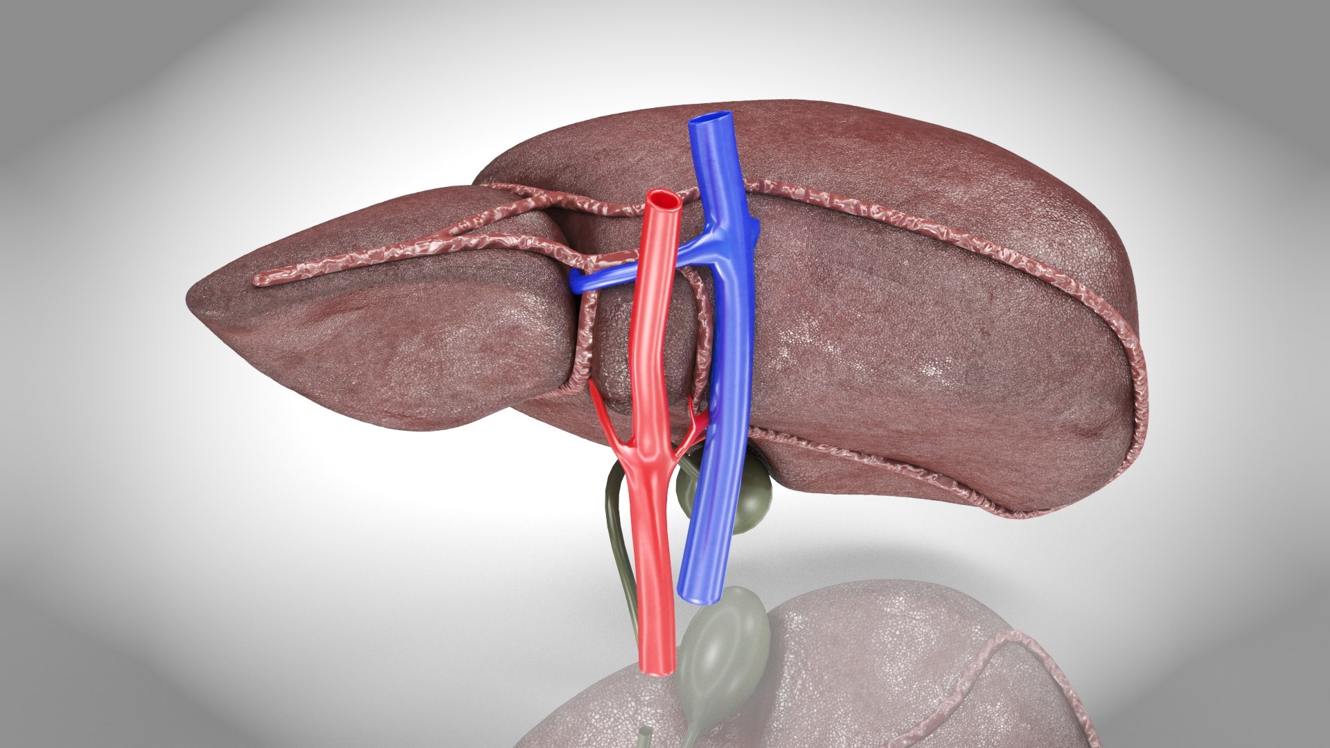 3D Fatty Liver Steatosis - TurboSquid 2132775