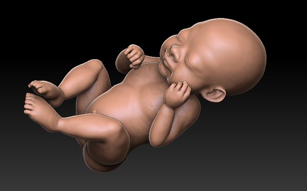 Salvan la vida de un bebé al replicar un modelo 3D de su cráneo