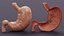 3D Stomach and Stomach Section