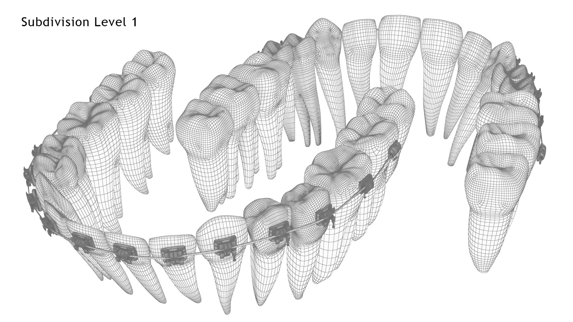 3D Human Teeth With Self Ligating Transparent Dental Braces V01 model https://p.turbosquid.com/ts-thumb/6S/lOxmjB/6A/dentitionwithselfligatingsteeldentalbraces_wire6.1/jpg/1699202263/1920x1080/fit_q87/72115a234521618564c5b880463567f2bdd5186d/dentitionwithselfligatingsteeldentalbraces_wire6.1.jpg