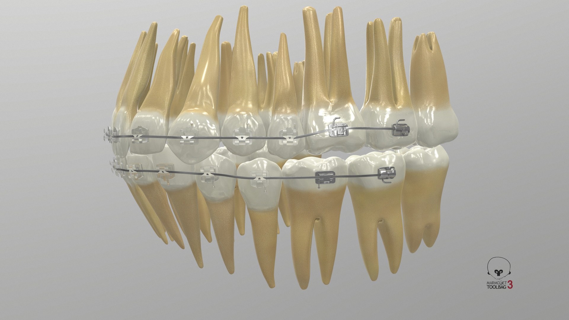 3D Human Teeth With Self Ligating Transparent Dental Braces V01 model https://p.turbosquid.com/ts-thumb/6S/lOxmjB/AO/screenshot001/jpg/1699201690/1920x1080/fit_q87/33b2dd9eed7275990d33ddac92888d54bd7a5426/screenshot001.jpg