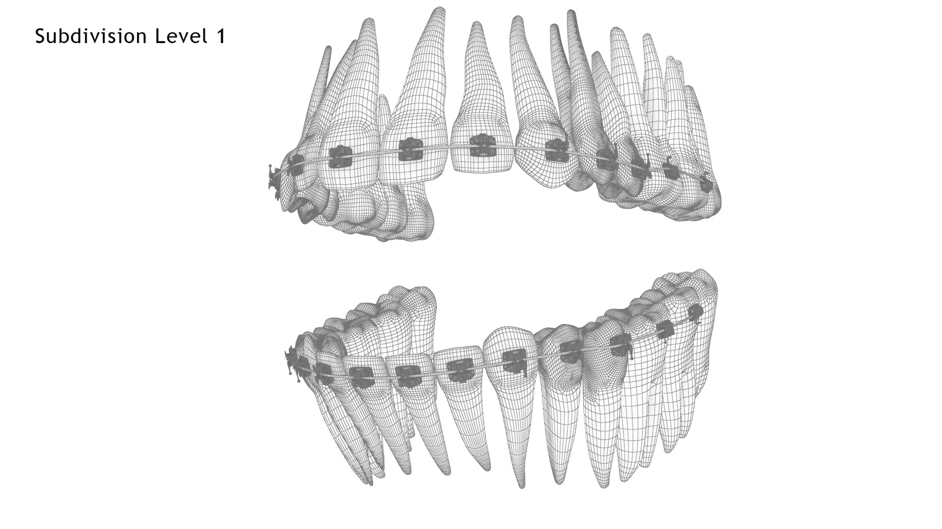 3D Human Teeth With Self Ligating Transparent Dental Braces V01 model https://p.turbosquid.com/ts-thumb/6S/lOxmjB/Au/dentitionwithselfligatingsteeldentalbraces_wire2.1/jpg/1699202253/1920x1080/fit_q87/3bfd07d80326cb871f88d32398a413dbadd3a8a5/dentitionwithselfligatingsteeldentalbraces_wire2.1.jpg