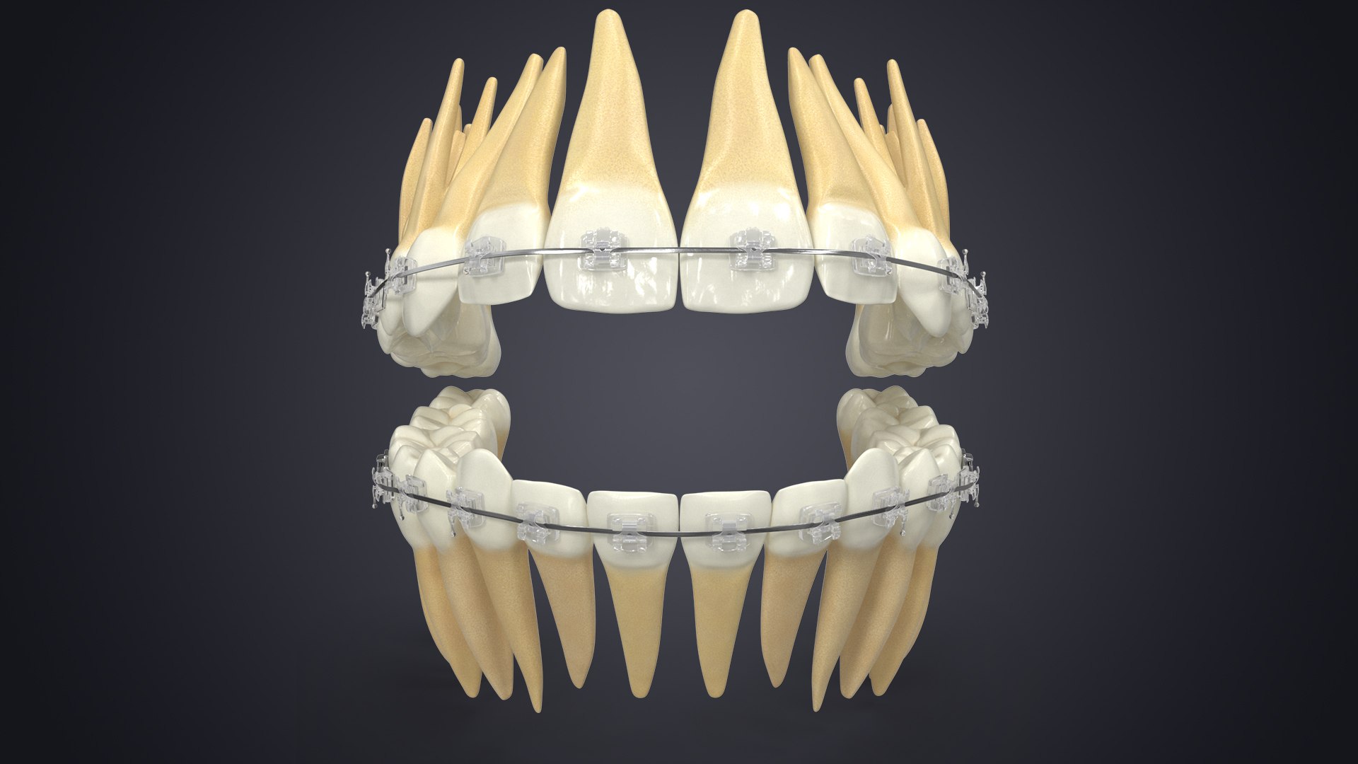 3D Human Teeth With Self Ligating Transparent Dental Braces V01 model https://p.turbosquid.com/ts-thumb/6S/lOxmjB/D1/contextsignature/jpg/1699200483/1920x1080/fit_q87/c13b1f576f2012370c2b6e8e72ea3199a6575d41/contextsignature.jpg