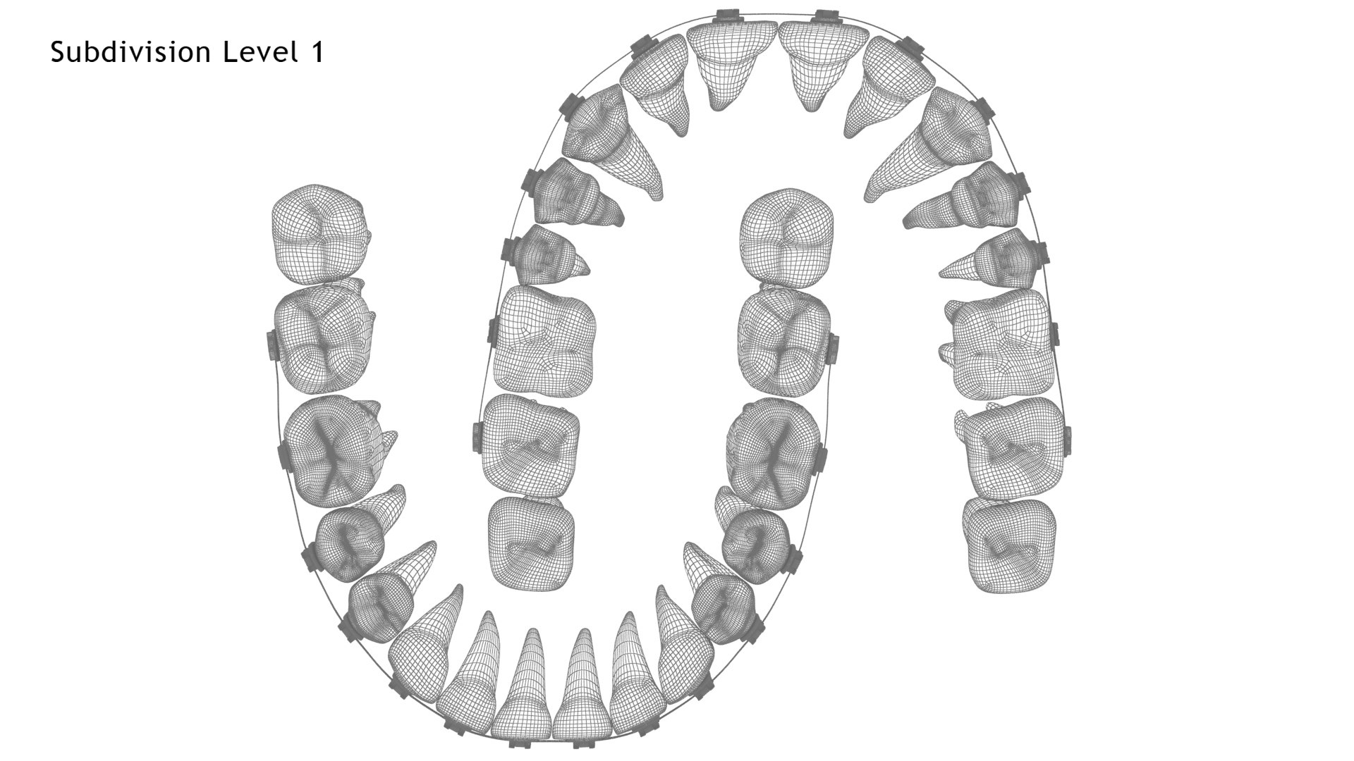 3D Human Teeth With Self Ligating Transparent Dental Braces V01 model https://p.turbosquid.com/ts-thumb/6S/lOxmjB/DL/dentitionwithselfligatingsteeldentalbraces_wire5.1/jpg/1699202261/1920x1080/fit_q87/ef7804c989db3e6572d06a81f388b7429ae3e8c0/dentitionwithselfligatingsteeldentalbraces_wire5.1.jpg