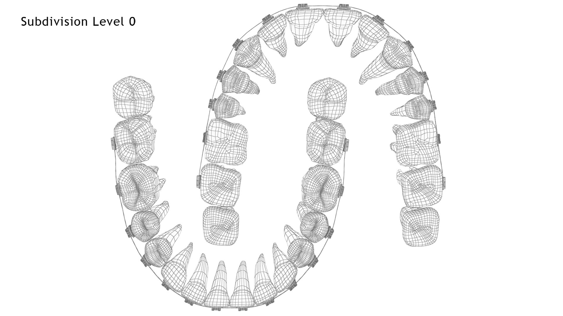 3D Human Teeth With Self Ligating Transparent Dental Braces V01 model https://p.turbosquid.com/ts-thumb/6S/lOxmjB/Jx/dentitionwithselfligatingsteeldentalbraces_wire5.0/jpg/1699202265/1920x1080/fit_q87/6b6482ed1697e54072c5b7944631c1272158f226/dentitionwithselfligatingsteeldentalbraces_wire5.0.jpg