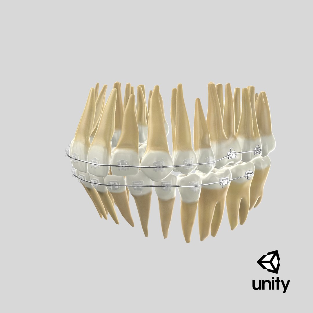 3D Human Teeth With Self Ligating Transparent Dental Braces V01 model https://p.turbosquid.com/ts-thumb/6S/lOxmjB/Q7/stemcell_unity_render/png/1701842524/1920x1080/fit_q87/eecf9855bbf2fbf14837322ae0f83ed2af98abfa/stemcell_unity_render.jpg