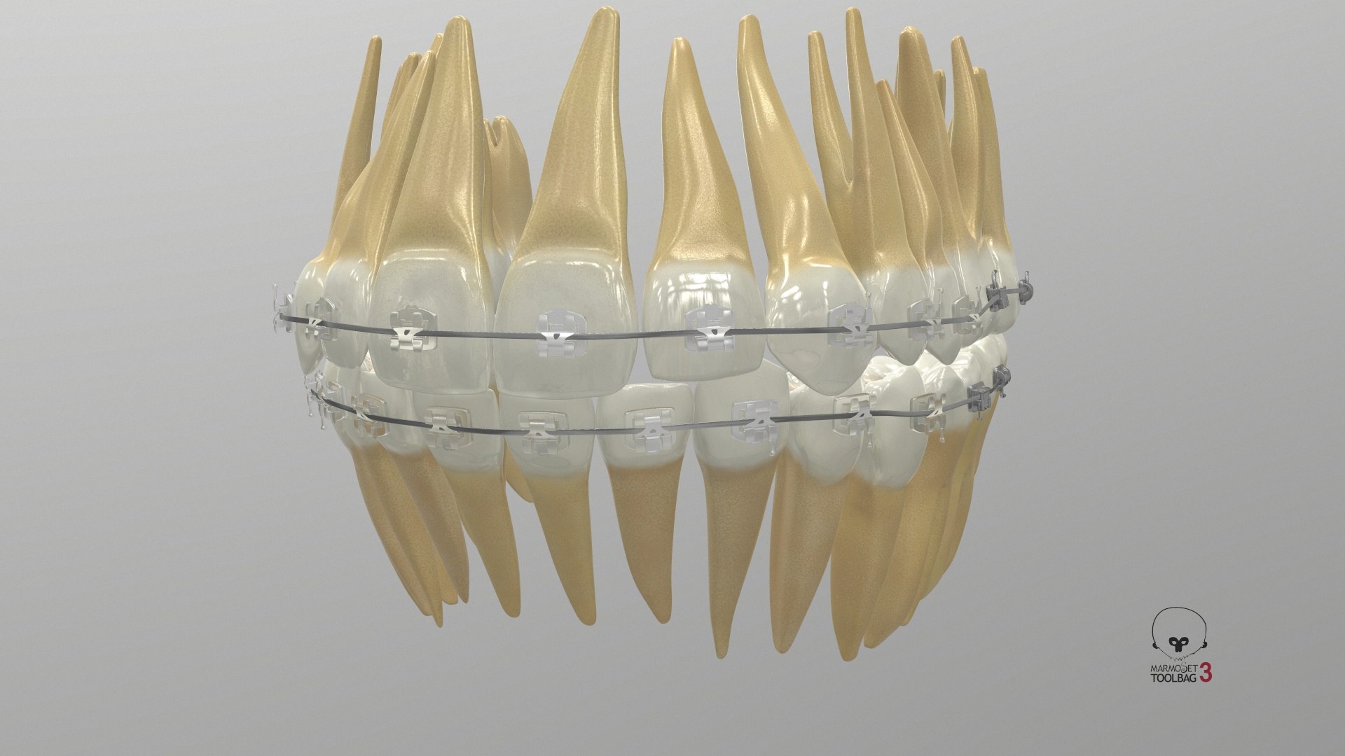 3D Human Teeth With Self Ligating Transparent Dental Braces V01 model https://p.turbosquid.com/ts-thumb/6S/lOxmjB/Va/screenshot000/jpg/1699201686/1920x1080/fit_q87/3ca704700a57a9d67ed0253e04ba57916752e519/screenshot000.jpg