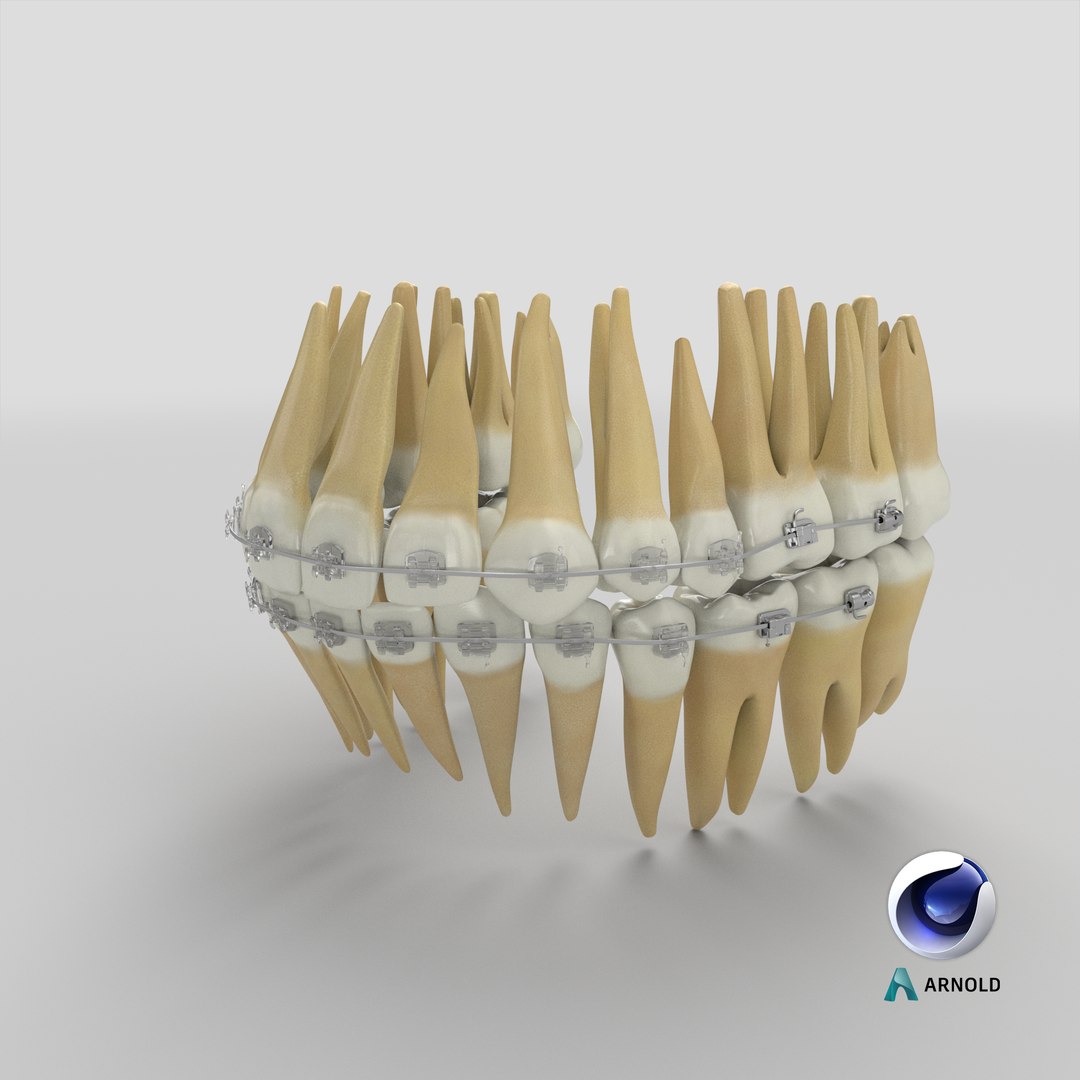3D Human Teeth With Self Ligating Transparent Dental Braces V01 model https://p.turbosquid.com/ts-thumb/6S/lOxmjB/ah/stemcell_cinema_4d_arnold_render/png/1701842526/1920x1080/fit_q87/9edf9a1a61c007c4168976a6c9c6696a9e7bf30b/stemcell_cinema_4d_arnold_render.jpg