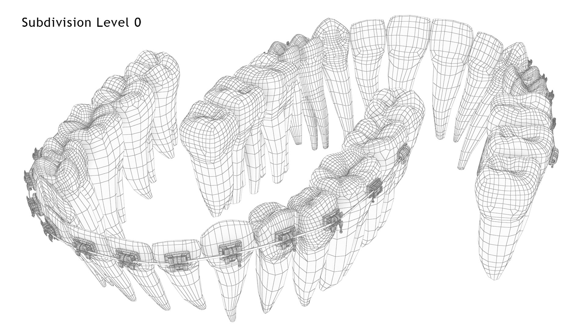 3D Human Teeth With Self Ligating Transparent Dental Braces V01 model https://p.turbosquid.com/ts-thumb/6S/lOxmjB/dD/dentitionwithselfligatingsteeldentalbraces_wire6.0/jpg/1699202261/1920x1080/fit_q87/a41547cc164cecdbe92c6efcadb3cb31aa0709eb/dentitionwithselfligatingsteeldentalbraces_wire6.0.jpg