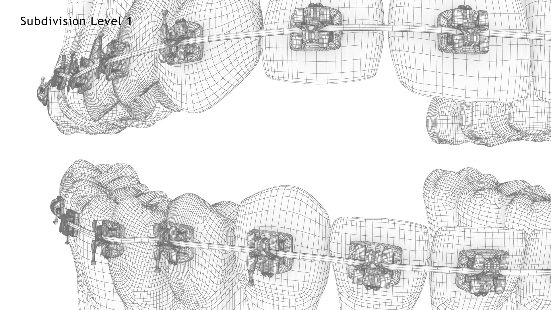 3D Human Teeth With Self Ligating Transparent Dental Braces V01 model https://p.turbosquid.com/ts-thumb/6S/lOxmjB/qP/dentitionwithselfligatingsteeldentalbraces_wire9.1/jpg/1699202270/1920x1080/fit_q87/635951e21c7469d38e39a3ce6a067b6506fee9ac/dentitionwithselfligatingsteeldentalbraces_wire9.1.jpg