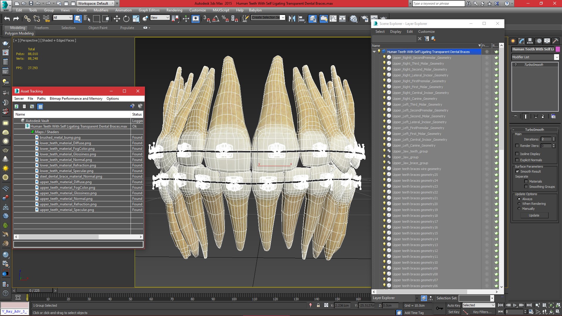 3D Human Teeth With Self Ligating Transparent Dental Braces V01 model https://p.turbosquid.com/ts-thumb/6S/lOxmjB/v7/viewport/jpg/1699202280/1920x1080/fit_q87/45f3adfa811895b5d57e9a8d25fef63f357c702b/viewport.jpg