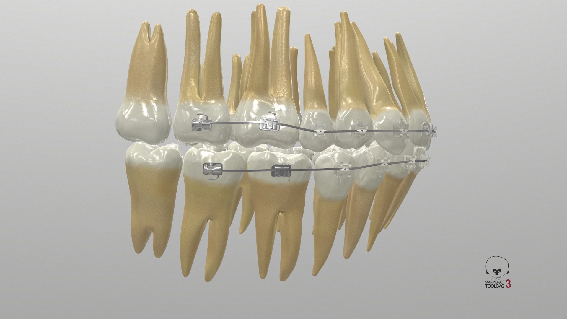3D Human Teeth With Self Ligating Transparent Dental Braces V01 model https://p.turbosquid.com/ts-thumb/6S/lOxmjB/yj/screenshot003/jpg/1699201701/1920x1080/fit_q87/6fc8078a31ea3133288ba90badcc60060c1962fc/screenshot003.jpg