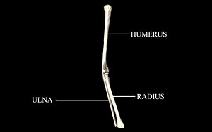 Elbow Joint Bones : Humerus, Radius, Ulna -  Medically Accurate 3d Model