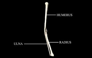 Elbow Joint Bones : Humerus, Radius, Ulna - Medically Accurate 3d Model