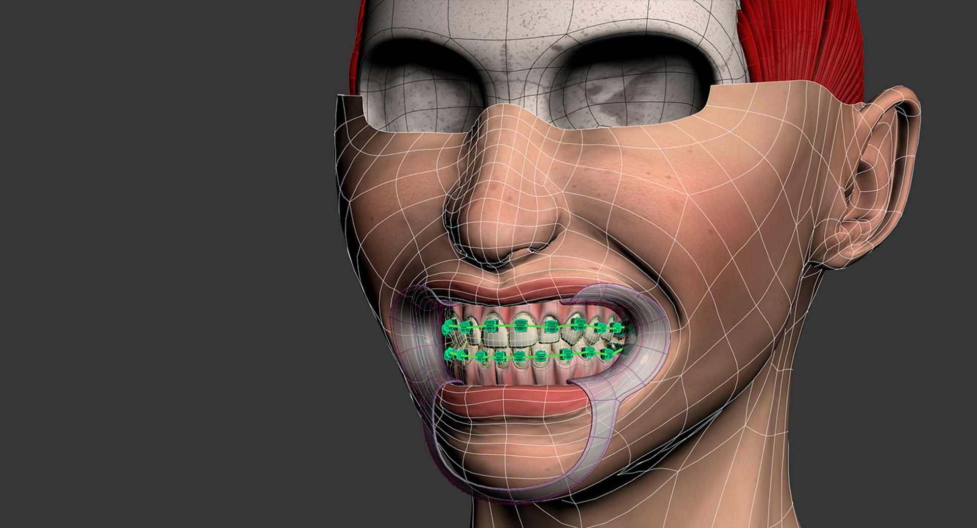 mouth orthodontics dental v4 max https://p.turbosquid.com/ts-thumb/6a/EwjCaR/3ltghy3p/wire4/jpg/1459174129/1920x1080/fit_q87/4346a3ce03d586e5cf186d787a3b8148e50398c5/wire4.jpg