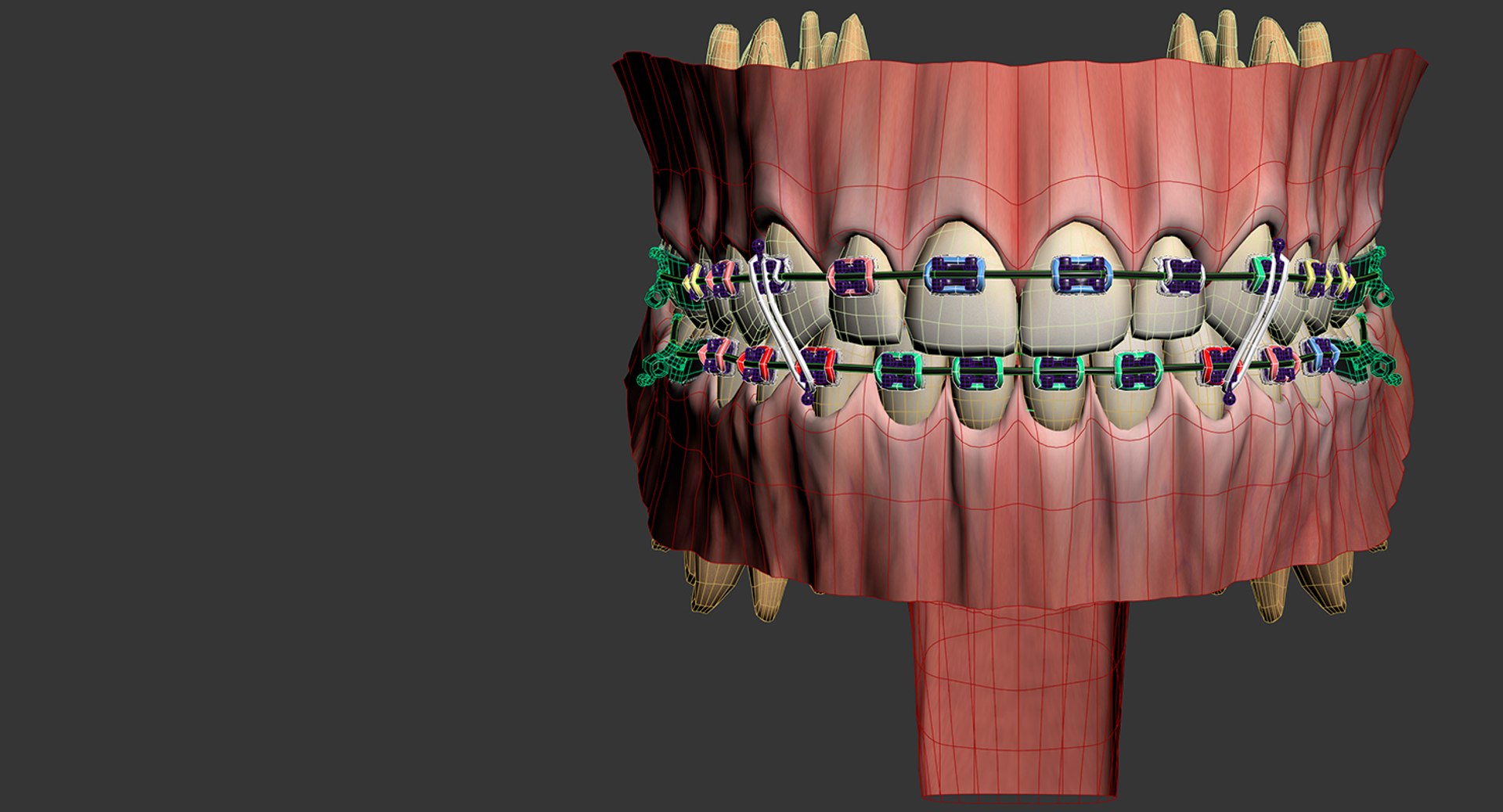 mouth orthodontics dental v4 max https://p.turbosquid.com/ts-thumb/6a/EwjCaR/FwNRfMMY/wire6/jpg/1459174129/1920x1080/fit_q87/ccde65c2b1f02b52e69712f39b61034eb5417f62/wire6.jpg