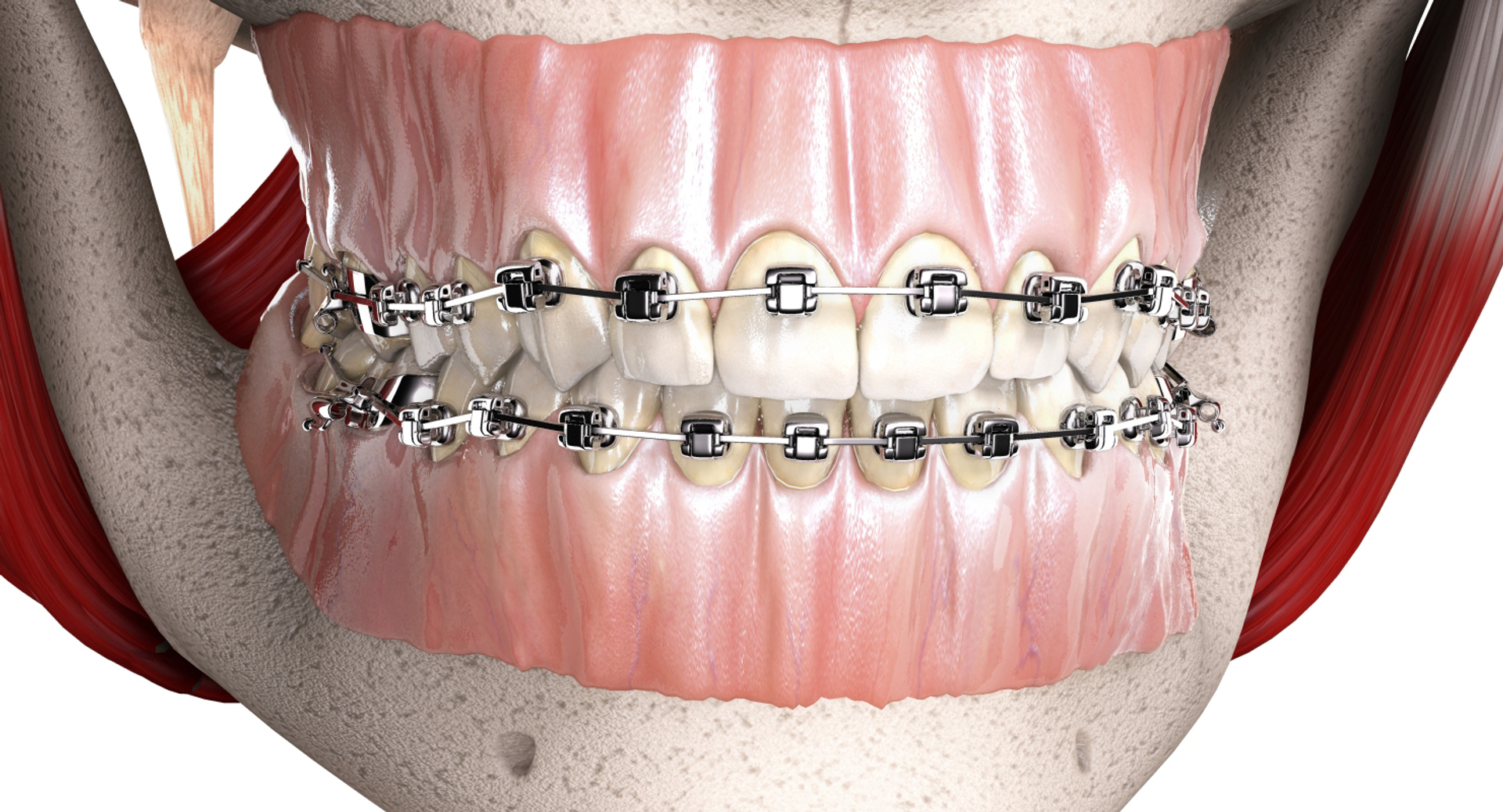 mouth orthodontics dental v4 max https://p.turbosquid.com/ts-thumb/6a/EwjCaR/Nu5CvwVt/muscles/jpg/1459120083/1920x1080/turn_fit_q99/b3a4a9b90aafbe07483fb4b25e464953a658052c/muscles-1.jpg