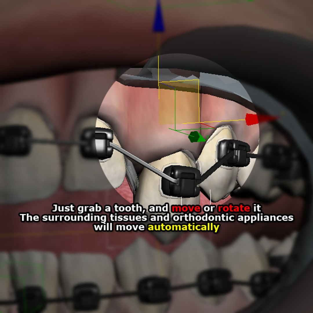 mouth orthodontics dental v4 max https://p.turbosquid.com/ts-thumb/6a/EwjCaR/cOG6yLK7/auto/jpg/1299299479/1920x1080/fit_q87/664c54d87ddb2e061158729fdfd7e4ec4697c09f/auto.jpg