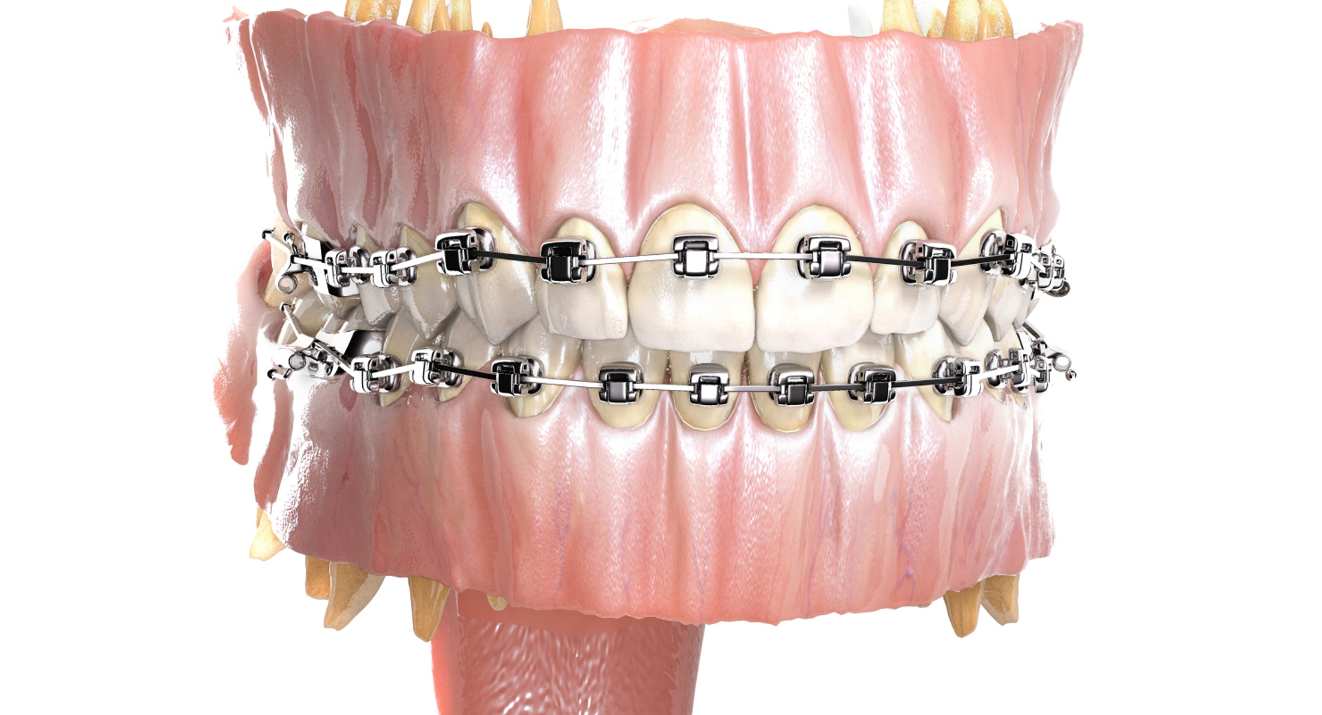 mouth orthodontics dental v4 max https://p.turbosquid.com/ts-thumb/6a/EwjCaR/iq46vGmR/mouthdamon/jpg/1459120204/1920x1080/turn_fit_q99/64ebcef86d82dfca06bee1bdd64335de4f2c6fe3/mouthdamon-1.jpg