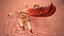 Louse with Blood Eating Pose