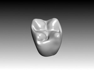 3d second molar maxilar
