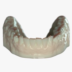 Lower Denture B mold