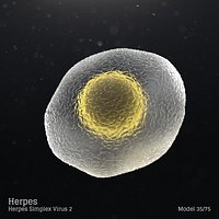 Herpes - Herpes Simplex Virus 2