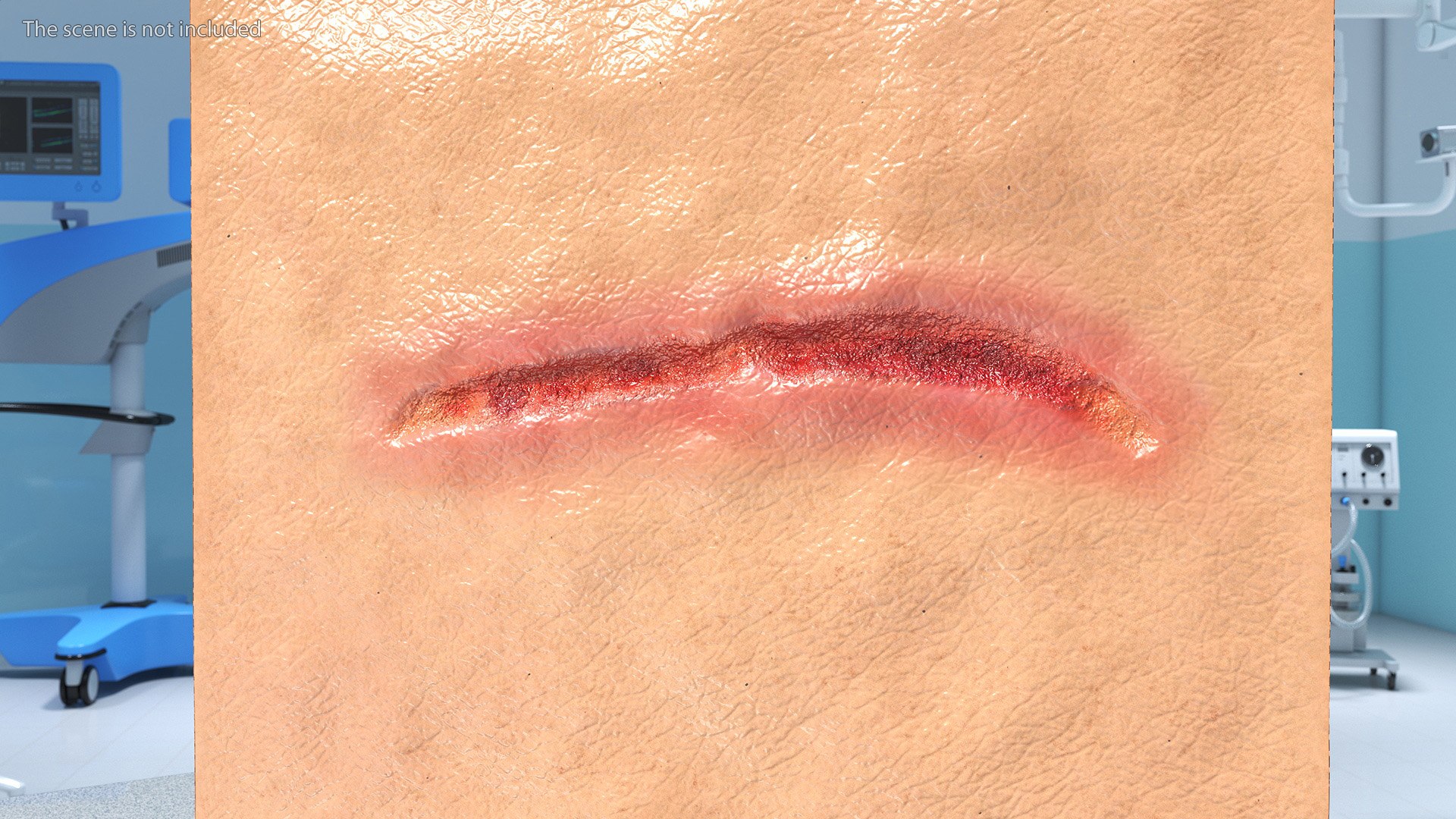 Medical Cut Skin Surfaces Collection 3D https://p.turbosquid.com/ts-thumb/7i/9Jetg6/3q/medicalcutskinsurfacescollectionc4dmodel029/jpg/1704342766/1920x1080/fit_q87/acb35581631f0cd2d313769e235662f9aaad2d4c/medicalcutskinsurfacescollectionc4dmodel029.jpg