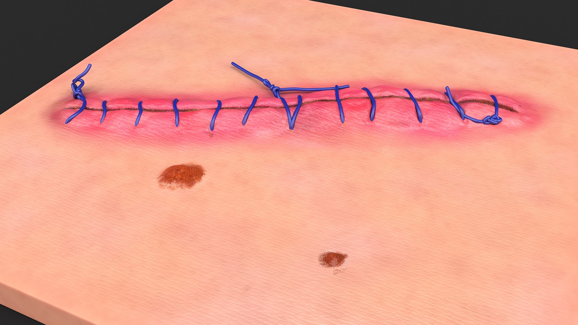 Medical Cut Skin Surfaces Collection 3D https://p.turbosquid.com/ts-thumb/7i/9Jetg6/49/medicalcutskinsurfacescollectionc4dmodel007/jpg/1704342688/1920x1080/fit_q87/e303fa29b77bc41a644899a61975b7a0ce294bbb/medicalcutskinsurfacescollectionc4dmodel007.jpg