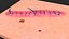 医療切断皮膚表面コレクション