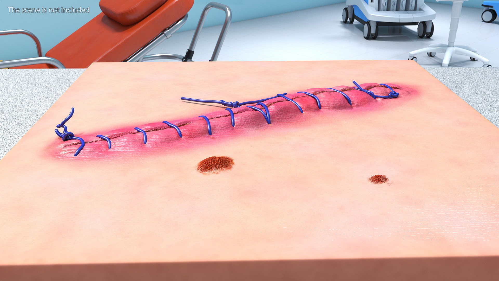 Medical Cut Skin Surfaces Collection 3D https://p.turbosquid.com/ts-thumb/7i/9Jetg6/AD/medicalcutskinsurfacescollectionc4dmodel003/jpg/1704342674/1920x1080/fit_q87/cba6b68aaabbaa0c5b4c9c590180bc83ad401713/medicalcutskinsurfacescollectionc4dmodel003.jpg