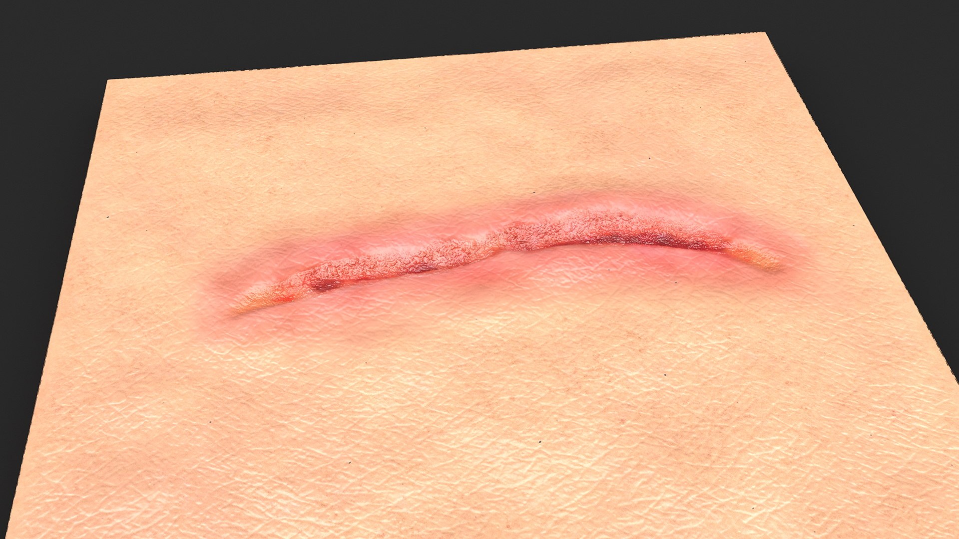 Medical Cut Skin Surfaces Collection 3D https://p.turbosquid.com/ts-thumb/7i/9Jetg6/Bp/medicalcutskinsurfacescollectionc4dmodel032/jpg/1704342778/1920x1080/fit_q87/78c2507b846af2d92d175e59fff0dd5909213a18/medicalcutskinsurfacescollectionc4dmodel032.jpg
