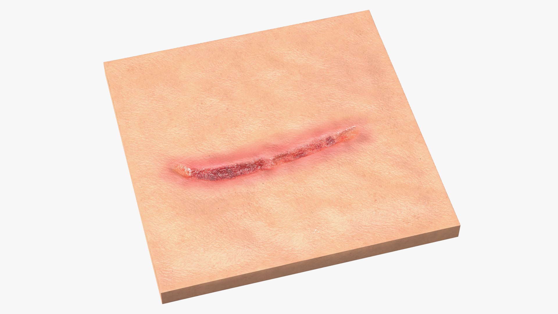 Medical Cut Skin Surfaces Collection 3D https://p.turbosquid.com/ts-thumb/7i/9Jetg6/Dh/medicalcutskinsurfacescollectionc4dmodel034/jpg/1704342785/1920x1080/fit_q87/3db3a359366f0460803f413a701436d94b23f91c/medicalcutskinsurfacescollectionc4dmodel034.jpg